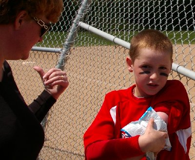 Grandson Riley icing down his sore arm at Heidelberg Park in Tacoma, Washington.